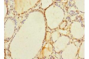 Immunohistochemistry of paraffin-embedded human thyroid tissue using ABIN7171504 at dilution of 1:100 (TAPBPL antibody  (AA 201-468))