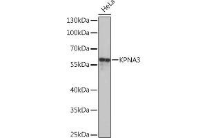 Western blot analysis of extracts of HeLa cells, using KPN Rabbit pAb  at 1:1000 dilution. (KPNA3 antibody  (AA 1-210))