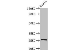 Western Blot Positive WB detected in: Mouse brain tissue All lanes: BTG4 antibody at 3 μg/mL Secondary Goat polyclonal to rabbit IgG at 1/50000 dilution Predicted band size: 26, 25 kDa Observed band size: 26 kDa (BTG4 antibody  (AA 1-206))