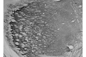 Adult rat thalamus immunohistochemistry.