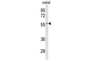 Image no. 1 for anti-Cytochrome P450, Family 2, Subfamily C, Polypeptide 19 (CYP2C19) (Middle Region) antibody (ABIN452898) (CYP2C19 antibody  (Middle Region))