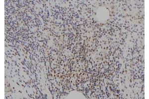 ABIN6273721 at 1/100 staining Human spleen tissue by IHC-P. (E2F8 antibody  (C-Term))
