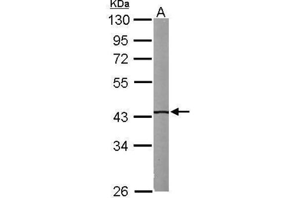 IVD antibody