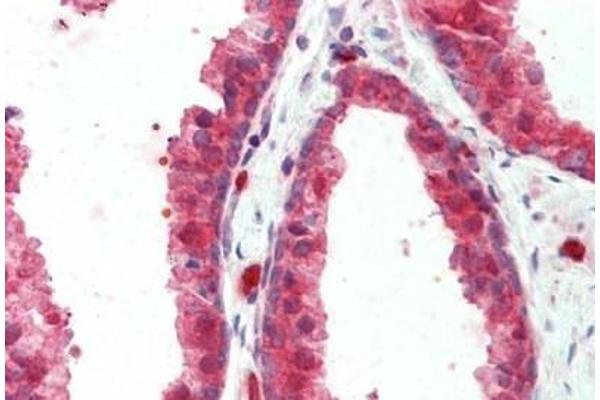 CCDC22 antibody  (N-Term)