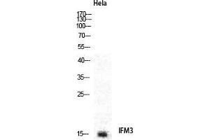 Western Blot (WB) analysis of specific cells using IFITM3 Polyclonal Antibody.