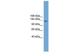 CCDC146 antibody used at 1 ug/ml to detect target protein. (CCDC146 antibody  (Middle Region))