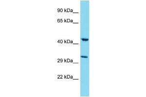 Western Blotting (WB) image for anti-Myb/SANT-Like DNA-Binding Domain Containing 4 with Coiled-Coils (MSANTD4) (N-Term) antibody (ABIN2791619) (MSANTD4 antibody  (N-Term))