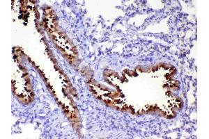 IHC analysis of HE4 using anti-HE4 antibody . (WFDC2 antibody  (AA 31-168))