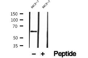 Western blot analysis of extracts of MCF-7 cells, using P4HA2 antibody.