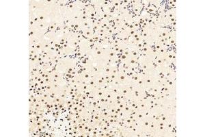 Immunohistochemistry (Paraffin-embedded Sections) (IHC (p)) image for anti-RNA Binding Motif Protein 8A (RBM8A) antibody (ABIN7075478)