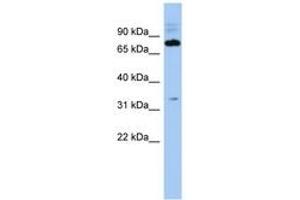 Image no. 1 for anti-Family with Sequence Similarity 161, Member B (FAM161B) (AA 566-615) antibody (ABIN6743691) (FAM161B antibody  (AA 566-615))