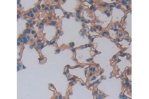 IHC-P analysis of lung tissue, with DAB staining. (NCR1 antibody  (AA 17-258))