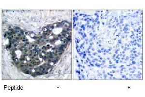 Image no. 1 for anti-DOK2 (DOK2) (AA 297-301) antibody (ABIN197541) (DOK2 antibody  (AA 297-301))