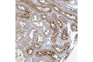 Immunohistochemical staining (Formalin-fixed paraffin-embedded sections) of human kidney with TNN polyclonal antibody  shows moderate membranous positivity in cells in tubules. (Tenascin N antibody)
