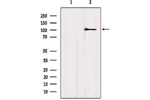 Western blot analysis of extracts from MCF7, using MYOCD Antibody. (Myocardin antibody  (Internal Region))