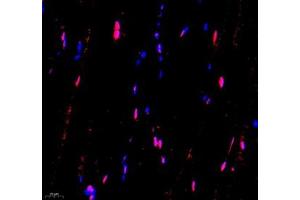 Immunofluorescence of paraffin embedded mouse Skeletal muscle using USP24 (ABIN7076111) at dilution of 1:650 (400x lens) (USP24 antibody)