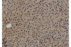 ABIN6263520 and ABIN6273271 at 1/100 staining Rat liver tissue by IHC-P. (NAT10 antibody  (Internal Region))