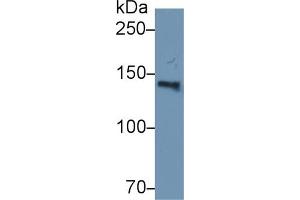 Western Blot; Sample: Human Serum; Primary Ab: 2µg/ml Rabbit Anti-Human HYOU1 Antibody Second Ab: 0. (150 kDa Oxygen Regulated Protein (AA 695-994) antibody)