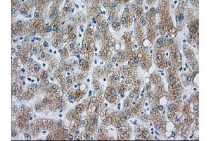 Immunohistochemical staining of paraffin-embedded liver tissue using anti-CYP1A2 mouse monoclonal antibody.
