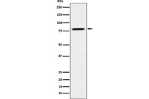 Western blot analysis of MUTA expression in HeLa cell lysate. (Recombinant MUT antibody)