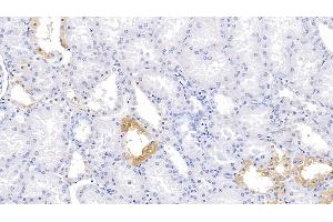 Detection of PBRM1 in Human Kidney Tissue using Polyclonal Antibody to Polybromo 1 (PBRM1) (Polybromo 1 antibody  (AA 1-306))