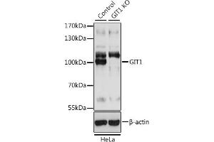 Western blot analysis of extracts from normal (control) and GIT1 knockout (KO) HeLa cells, using GIT1 antibody (ABIN7267383) at 1:3000 dilution.