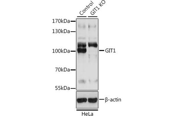 GIT1 anticorps  (AA 460-640)