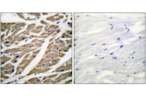 Immunohistochemistry analysis of paraffin-embedded human heart tissue, using Sodium Channel-pan Antibody. (Sodium Channel antibody  (AA 1466-1515))