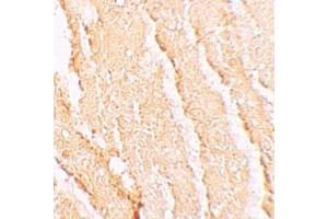Immunohistochemistry (IHC) image for anti-Vacuolar Protein Sorting 39 Homolog (VPS39) (C-Term) antibody (ABIN1030796) (VPS39 antibody  (C-Term))