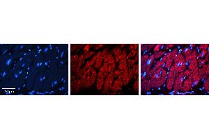 Rabbit Anti-INSR Antibody   Formalin Fixed Paraffin Embedded Tissue: Human heart Tissue Observed Staining: Cytoplasmic Primary Antibody Concentration: 1:100 Other Working Concentrations: 1:600 Secondary Antibody: Donkey anti-Rabbit-Cy3 Secondary Antibody Concentration: 1:200 Magnification: 20X Exposure Time: 0. (Insulin Receptor antibody  (Middle Region))