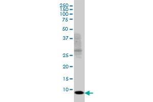 SH2D1A monoclonal antibody (M01), clone 1C9 Western Blot analysis of SH2D1A expression in Jurkat . (SH2D1A antibody  (AA 1-128))