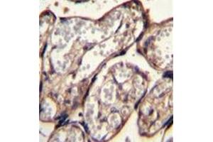 Formalin fixed and paraffin embedded human placenta tissue stained with IGF2 Antibody followed by peroxidase conjugation of the secondary antibody and DAB staining. (IGF2 antibody  (Middle Region))
