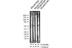 Western blot analysis of Phospho-p70 S6 Kinase beta (Ser423) expression in various lysates (RPS6KB2 antibody  (pSer423))