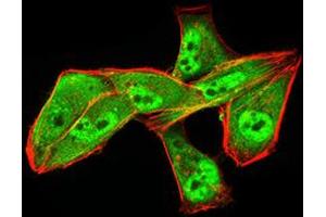 Immunocytochemistry (ICC) image for anti-Aldehyde Dehydrogenase 6 Family, Member A1 (ALDH6A1) (AA 1-195) antibody (ABIN5856297) (ALDH6A1 antibody  (AA 1-195))