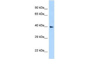 WB Suggested Anti-AIDA Antibody Titration: 1. (AIDA antibody  (N-Term))