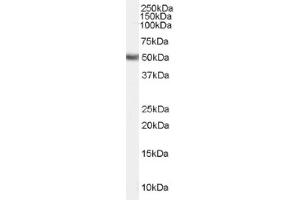 Image no. 1 for anti-Fatty Acid Desaturase 1 (FADS1) (Internal Region) antibody (ABIN374860) (FADS1 antibody  (Internal Region))