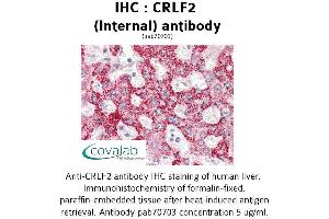 Image no. 2 for anti-Cytokine Receptor-Like Factor 2 (CRLF2) (Internal Region) antibody (ABIN1733318) (CRLF2 antibody  (Internal Region))