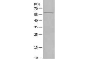 Western Blotting (WB) image for Insulin-Like Growth Factor 2 Receptor (IGF2R) (AA 2159-2491) protein (His-IF2DI Tag) (ABIN7123457) (IGF2R Protein (AA 2159-2491) (His-IF2DI Tag))