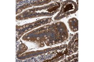 Immunohistochemical staining of human duodenum with FAM185A polyclonal antibody  strong cytoplasmic positivity in glandular cells at 1:50-1:200 dilution. (FAM185A antibody)