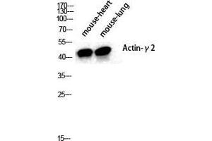 Western Blot (WB) analysis of specific cells using Actin alpha3 Polyclonal Antibody. (Actin Alpha3 (N-Term) antibody)