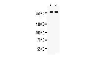 Western blot analysis of ABCA4 expression in rat eye extract ( Lane 1) and mouse eye extract ( Lane 2). (ABCA4 antibody  (C-Term))
