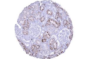 Moderate Napsin A immunostaining in proximal tubuli of the kidney (Recombinant NAPSA antibody  (AA 189-299))