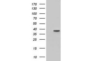 Western Blotting (WB) image for anti-3-hydroxyisobutyryl-CoA Hydrolase (HIBCH) antibody (ABIN1498655) (HIBCH antibody)