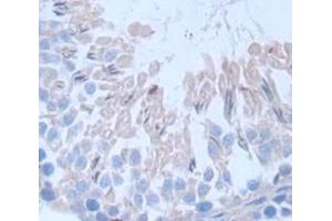 Figure. (FSIP1 antibody  (AA 109-328))