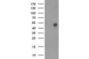 HEK293T cells were transfected with the pCMV6-ENTRY control (Left lane) or pCMV6-ENTRY BEST3 (Right lane) cDNA for 48 hrs and lysed. (Bestrophin 3 antibody)