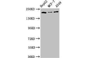 Western Blot Positive WB detected in: HepG2 whole cell lysate, MCF-7 whole cell lysate, A549 whole cell lysate, All lanes: OBSL1 antibody at 2. (Obscurin-Like 1 (OBSL1) (AA 1-61) antibody)