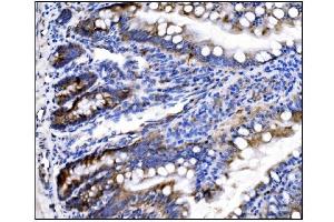 IHC analysis of HCCS using anti-HCCS antibody (ABIN7602424). (HCCS antibody  (AA 76-268))