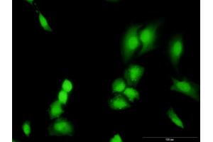 Immunofluorescence of monoclonal antibody to TRADD on HeLa cell. (TRADD antibody  (AA 203-312))