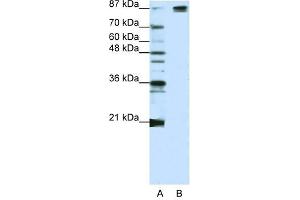 SF3B1 antibody used at 1. (SF3B1 antibody  (Middle Region))