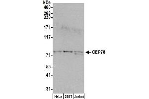 anti-Centrosomal Protein 78kDa (CEP78) (AA 639-689) antibody